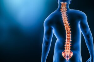 Scopri di più sull'articolo PALESTRA E SCOLIOSI: tra falsi miti ed allenamenti consigliati